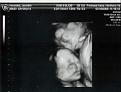 Click image for larger version

Name:	single.jpg
Views:	134
Size:	12.8 KB
ID:	149728